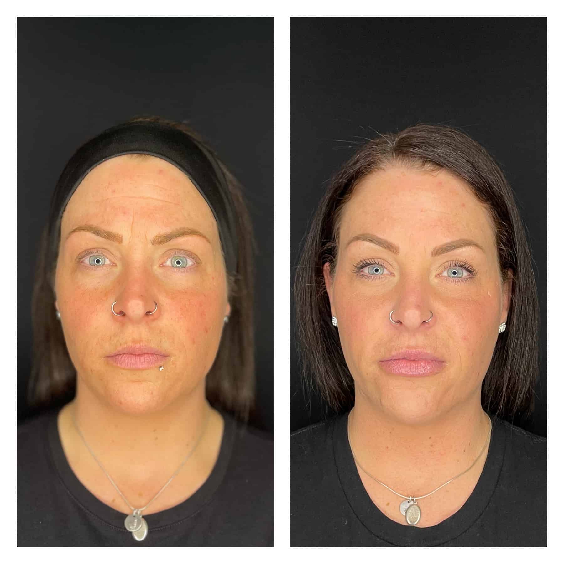 Bk-Before-And-After