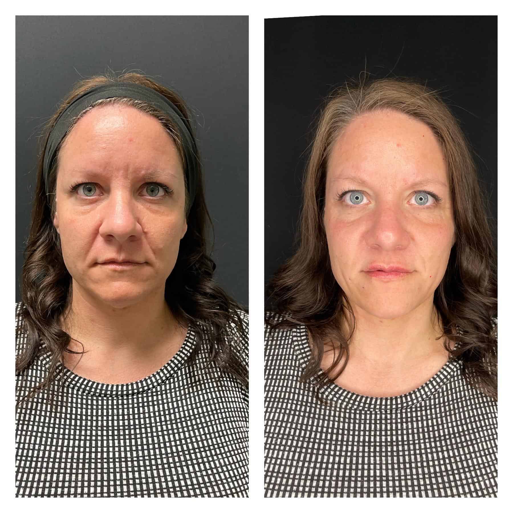 Ch-Before-And-After-2